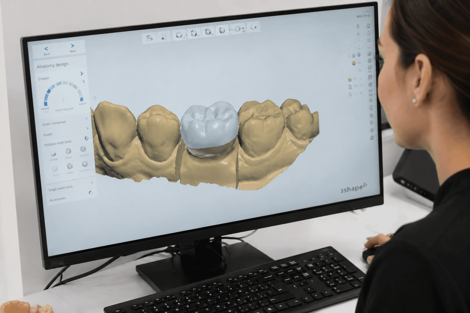 Dr. Nguyen Designs Your Crown — 3Shape CAD Software