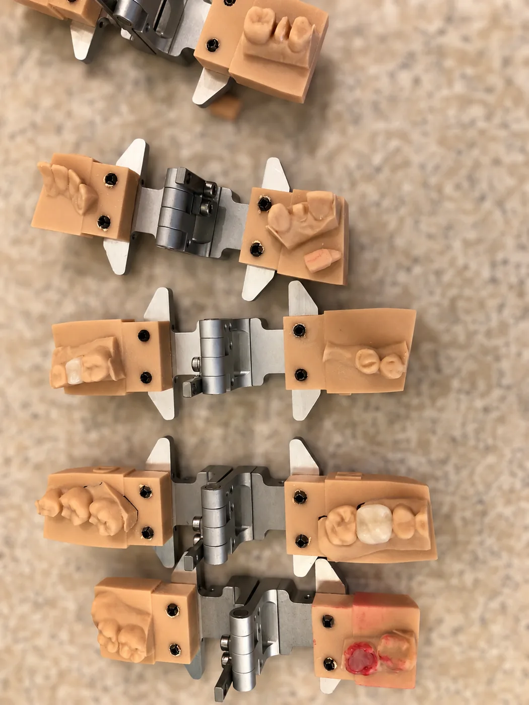 A stack of 3D-printed dental models mounted in articulators at SoftDental, with a white MCXL-milled ceramic crown placed on one of the molds